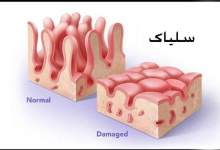 چند بیمار سلیاکی در کهگیلویه و بویراحمد شناسایی شد؟