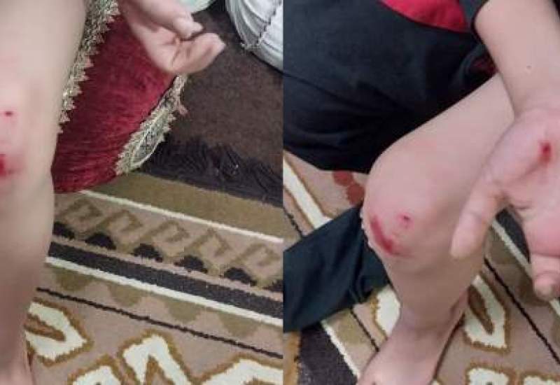 فیلم| حمله سگ‌ها به پسر بچه‌ای در خیابان یاسوج / قابل توجه مسئولان!  